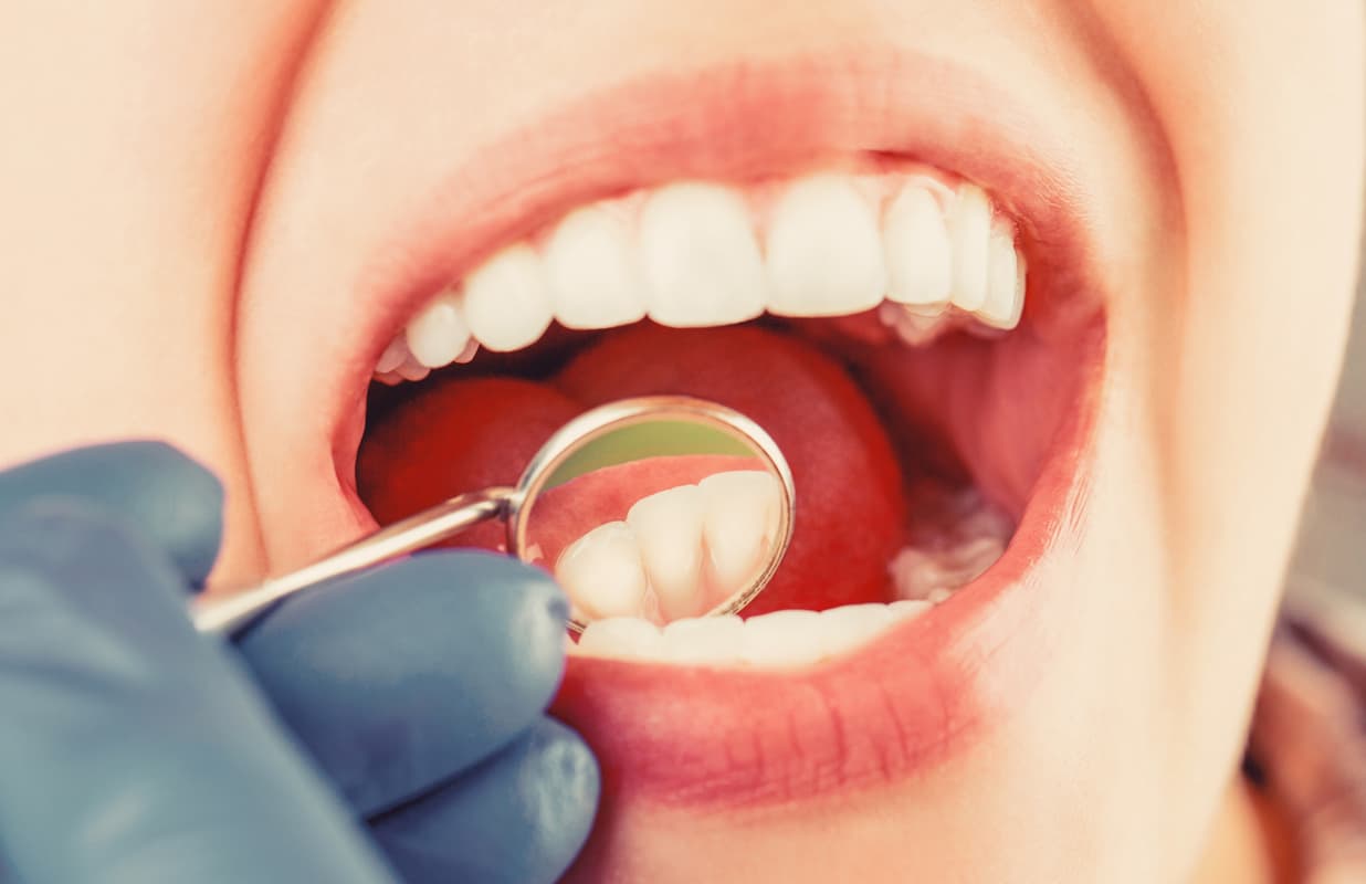Odontología general e implantes
